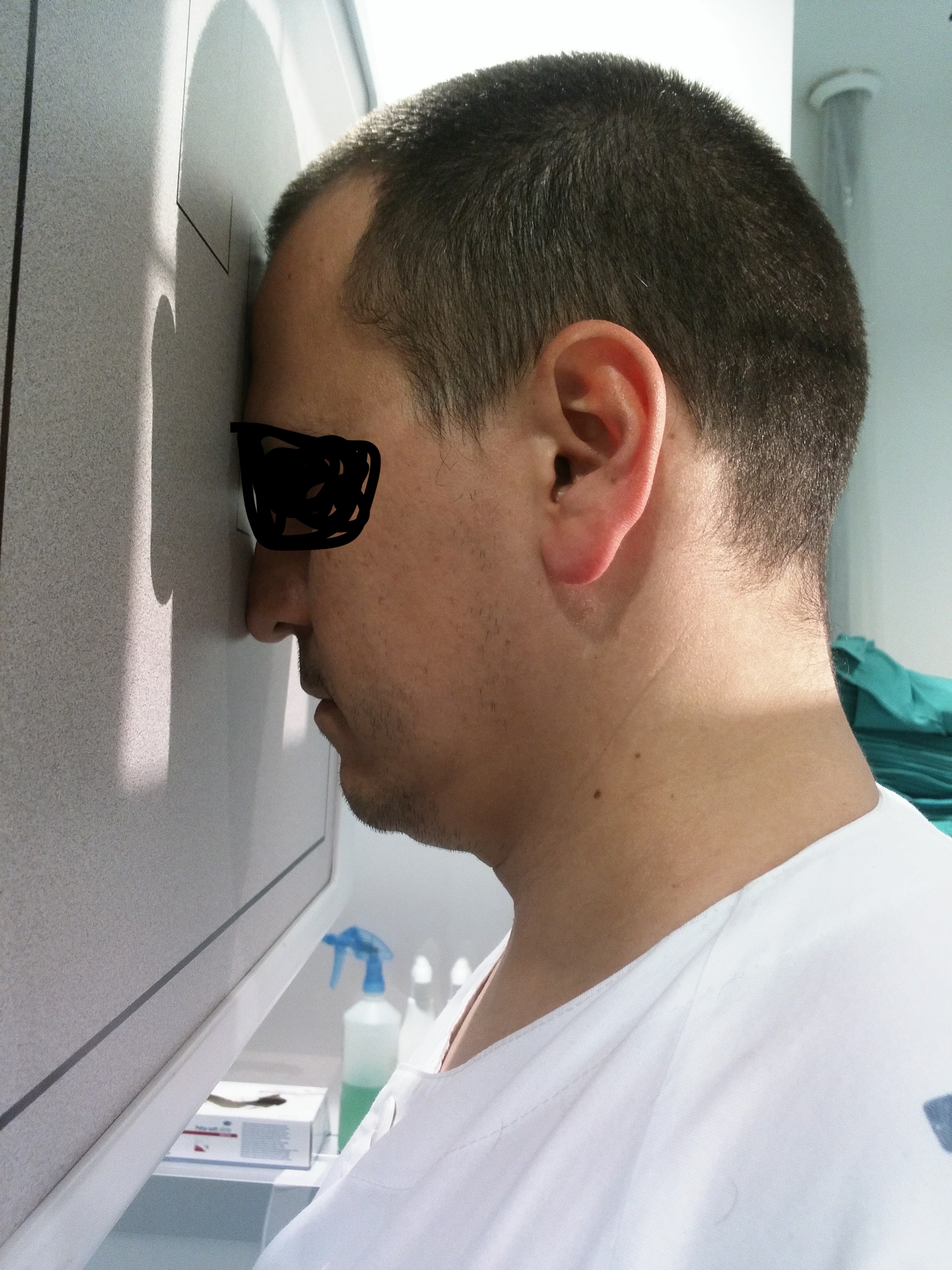 Proyección Caldwell